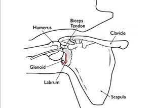 Diagram of the shoulder joint showing the labrum and biceps tendon